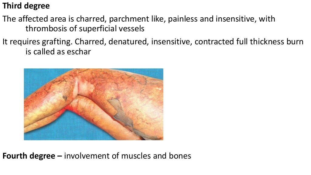 Fluid management in burns and shock