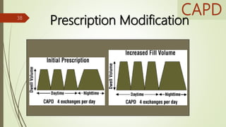 CAPD
Prescription Modification38
 