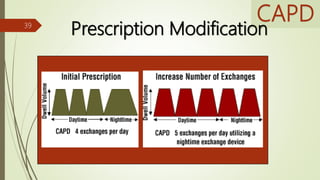 CAPD
Prescription Modification39
 