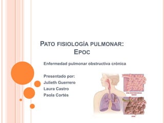 PATO FISIOLOGÍA PULMONAR:
           EPOC
 Enfermedad pulmonar obstructiva crónica


 Presentado por:
 Julieth Guerrero
 Laura Castro
 Paola Cortés
 