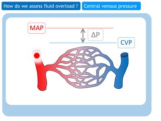 Assessment of fluid overload | PPTX