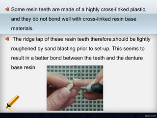 Resin Tooth Example Fluid_resin_technique, its uses in Prosthodontics, for making acrylic ...