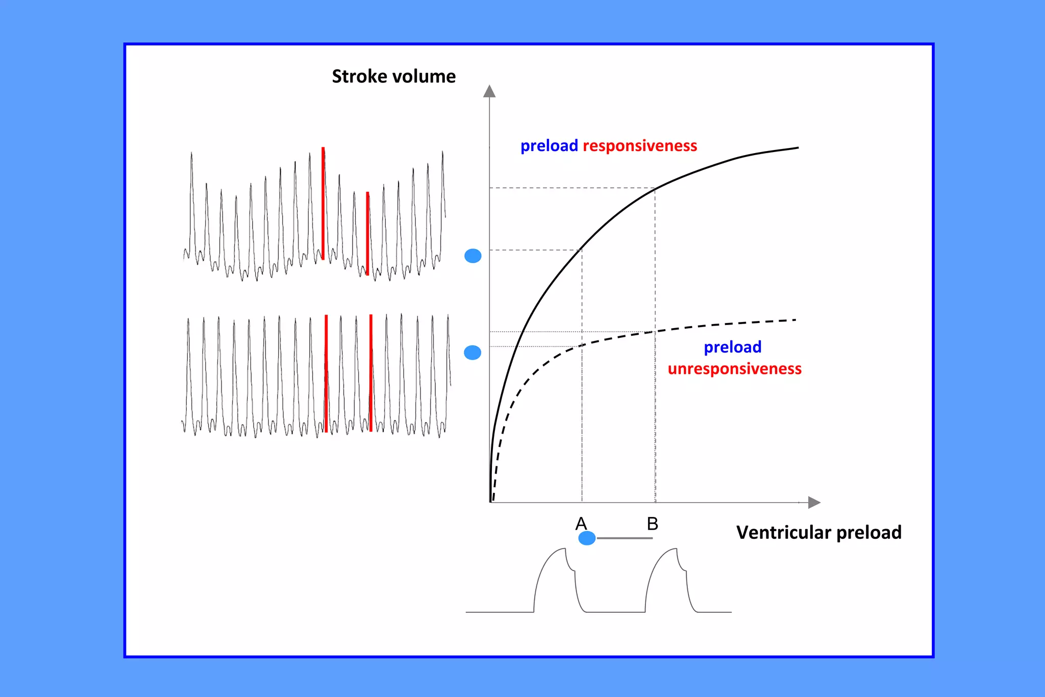 A B Ventricular preload
Stroke volume
preload responsiveness
preload
unresponsiveness
 