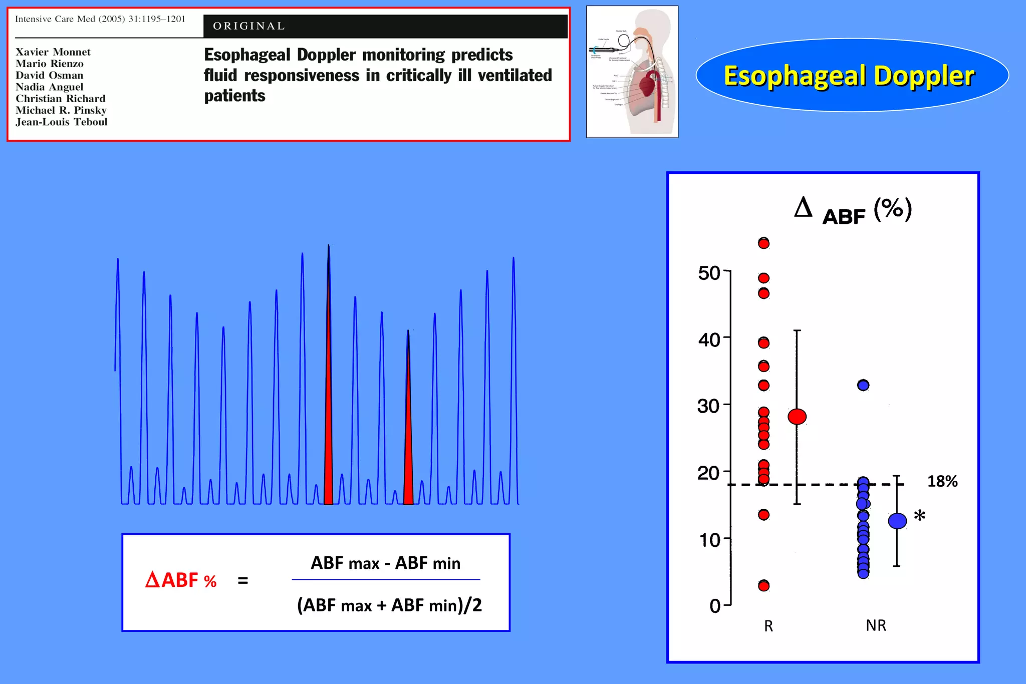 R NR
∆ABF % =
ABF max - ABF min
(ABF max + ABF min)/2
18%
Esophageal DopplerEsophageal Doppler
 