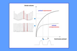 A B Ventricular preload
Stroke volume
preload responsiveness
preload
unresponsiveness
 