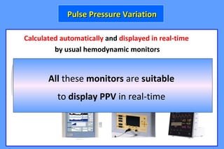 Calculated automatically and displayed in real-time
by usual hemodynamic monitors
Pulse Pressure VariationPulse Pressure Variation
All these monitors are suitable
to display PPV in real-time
 