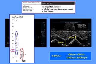 ∆∆ dIVC %dIVC % ==
dIVCdIVCmaxmax - dIVC- dIVCminmin
(dIVC(dIVCmaxmax + dIVCm+ dIVCminin)/2)/2
Subcostal view
dIVCmaxdIVCmax
dIVCmindIVCmin
 