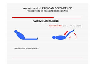 Assessment of PRELOAD DEPENDENCE
PREDICTION OF PRELOAD DEPENDENCE

PASSIVE LEG RAISING
Venous blood shift

(Rutlen et al. 1981, Reich et al. 1989)
1981,

45
°

Transient and reversible effect

 