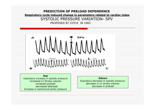 PREDICTION OF PRELOAD DEPENDENCE
Respiratory cycle induced change in parameters related to cardiac index

SYSTOLIC PRESSURE VARIATION- SPV
PROPOSED BY COYLE IN 1983

dup
inspiratory increase in systolic pressure:
increased LV Stroke volumeincreased preload
decreased afterload
Increase in extramural aortic pressure

Ddown
Expiratory decrease in systolic pressure:
decrease in LV stroke volumedecrease in preload

 
