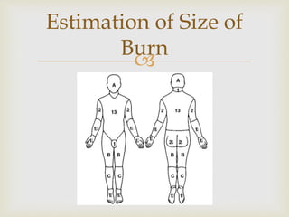 Estimation of Size of 
Burn 
 
 