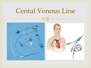 Cental Venous Line 
 
 
