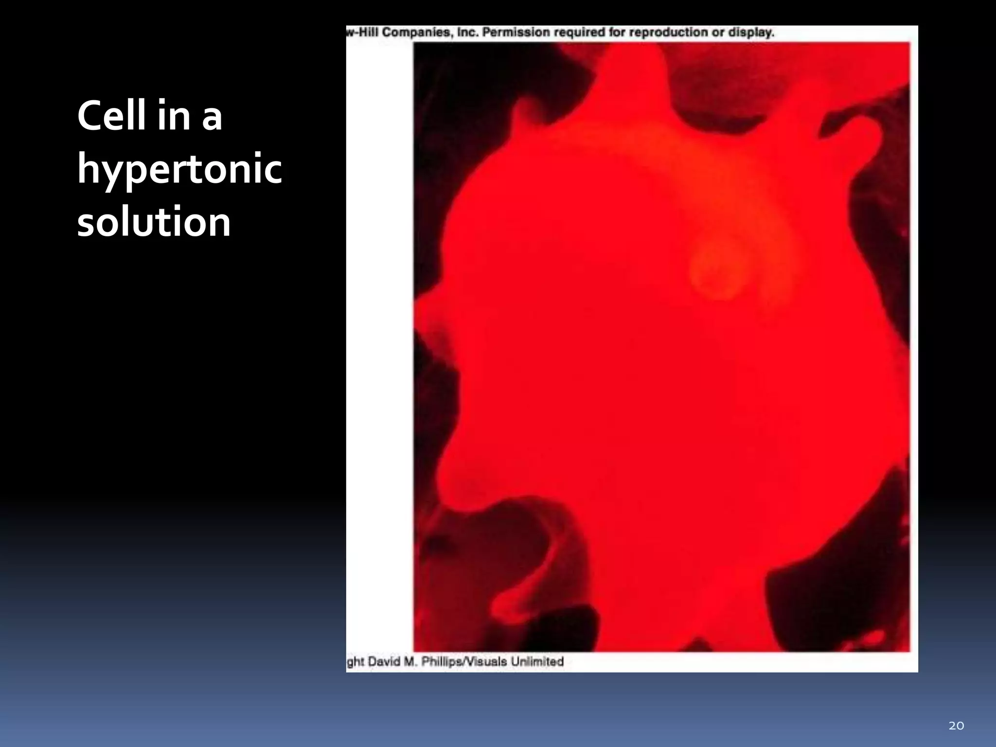 20Cell in a hypertonic solution