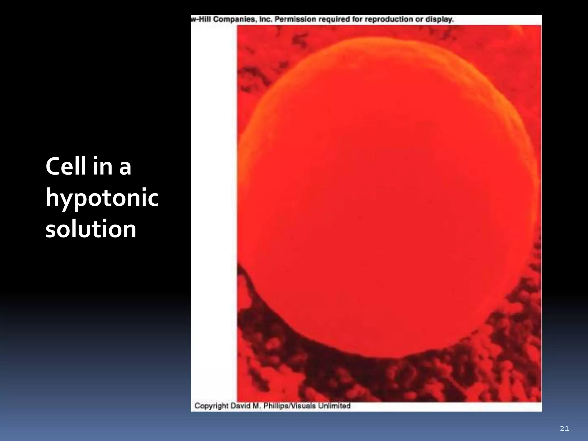 21Cell in a hypotonic solution
