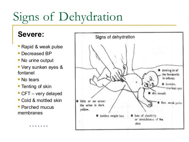 How do you treat dehydration?