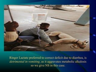 Ringer Lactate preferred to correct deficit due to diarrhea, is
detrimental in vomiting, as it aggravates metabolic alkalosis
so we give NS in this case.
 