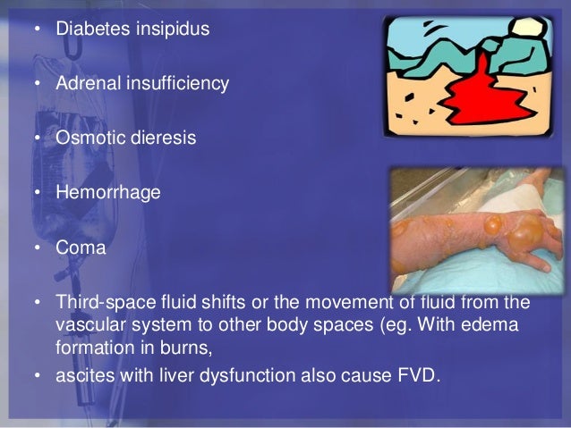 the body of 3 compartments fluid spacing edema blog.manicurex.ru  3rd