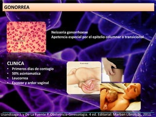 GONORREA
Neisseria gonorrhoeae
Apetencia especial por el epitelio columnar o transicional
CLINICA
• Primeros dias de contagio
• 50% asintomatica
• Leucorrea
• Escozor y ardor vaginal
Usandizaga J. y De La Fuente P. Obstetricia-Ginecologia. 4 ed. Editorial: Marban Libros, SL. 2011
 