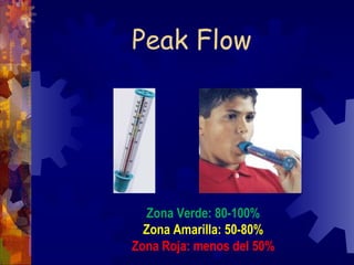 Flujometria Para Ni os cl flujometria-para-ni-os-cl