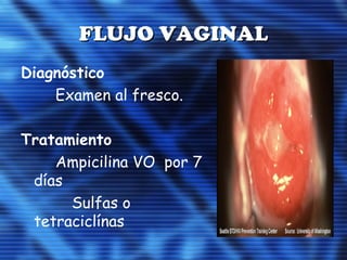 FLUJO VAGINALFLUJO VAGINAL
Diagnóstico
Examen al fresco.
Tratamiento
Ampicilina VO por 7
días
Sulfas o
tetraciclínas
 