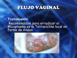 FLUJO VAGINALFLUJO VAGINAL
• Tratamiento:
Recomendable para erradicar el
Micoplasma es la Tetraciclina local en
forma de óvulos.
 