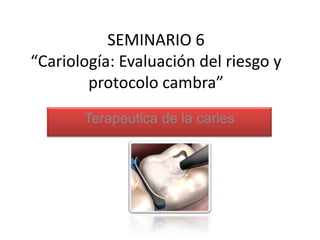 SEMINARIO 6
“Cariología: Evaluación del riesgo y
protocolo cambra”
Terapeutica de la caries
 