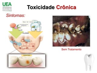 Toxicidade Crônica
Sintomas:




                        Sem Tratamento
 
