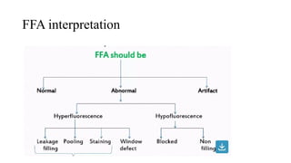 FLUORESCEIN ANGIOGRAPHY presentation in ophthalmology | PPTX