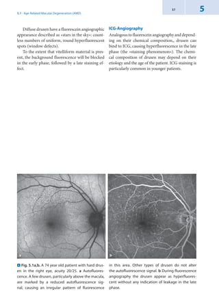 Fluorescence Angiography in Ophthalmology.pdf