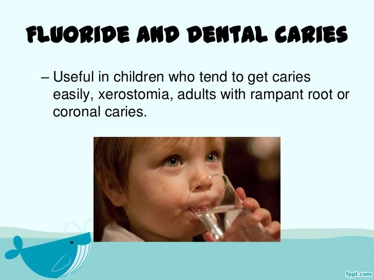 Fluoride and their role in dental caries prevention