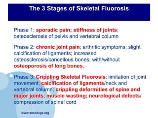 The 3 Stages of Skeletal Fluorosis


 Phase 1: sporadic pain; stiffness of joints;
  osteosclerosis of pelvis and vertebral column

 Phase 2: chronic joint pain; arthritic symptoms; slight
  calcification of ligaments; increased
  osteosclerosis/cancellous bones; with/without
  osteoporosis of long bones.

 Phase 3: Crippling Skeletal Fluorosis: limitation of joint
  movement; calcification of ligaments/neck and
  vertebral column; crippling deformities of spine and
  major joints; muscle wasting; neurological defects/
  compression of spinal cord
     www.ancollege.org
 