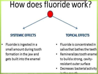Fluorides in dentistry