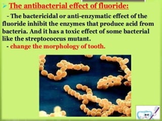 Fluorides in dentistry