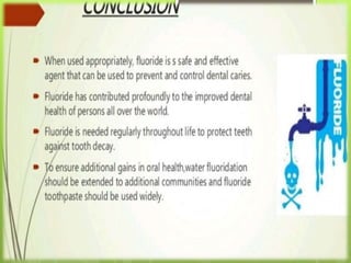 Fluorides in dentistry