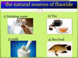 Fluorides in dentistry