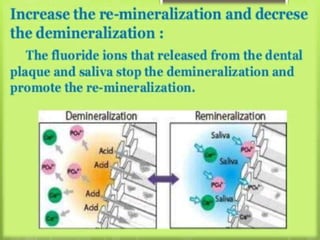 Fluorides in dentistry