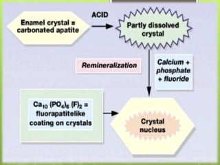 Fluorides in dentistry