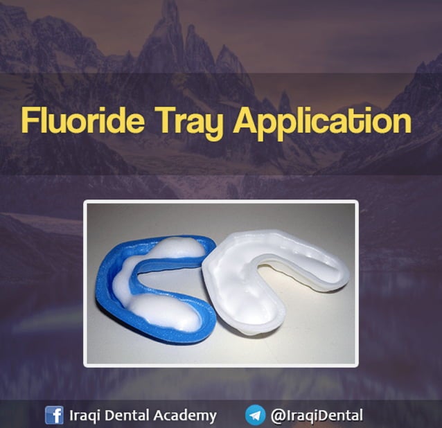 Fluoride Tray Application PPT