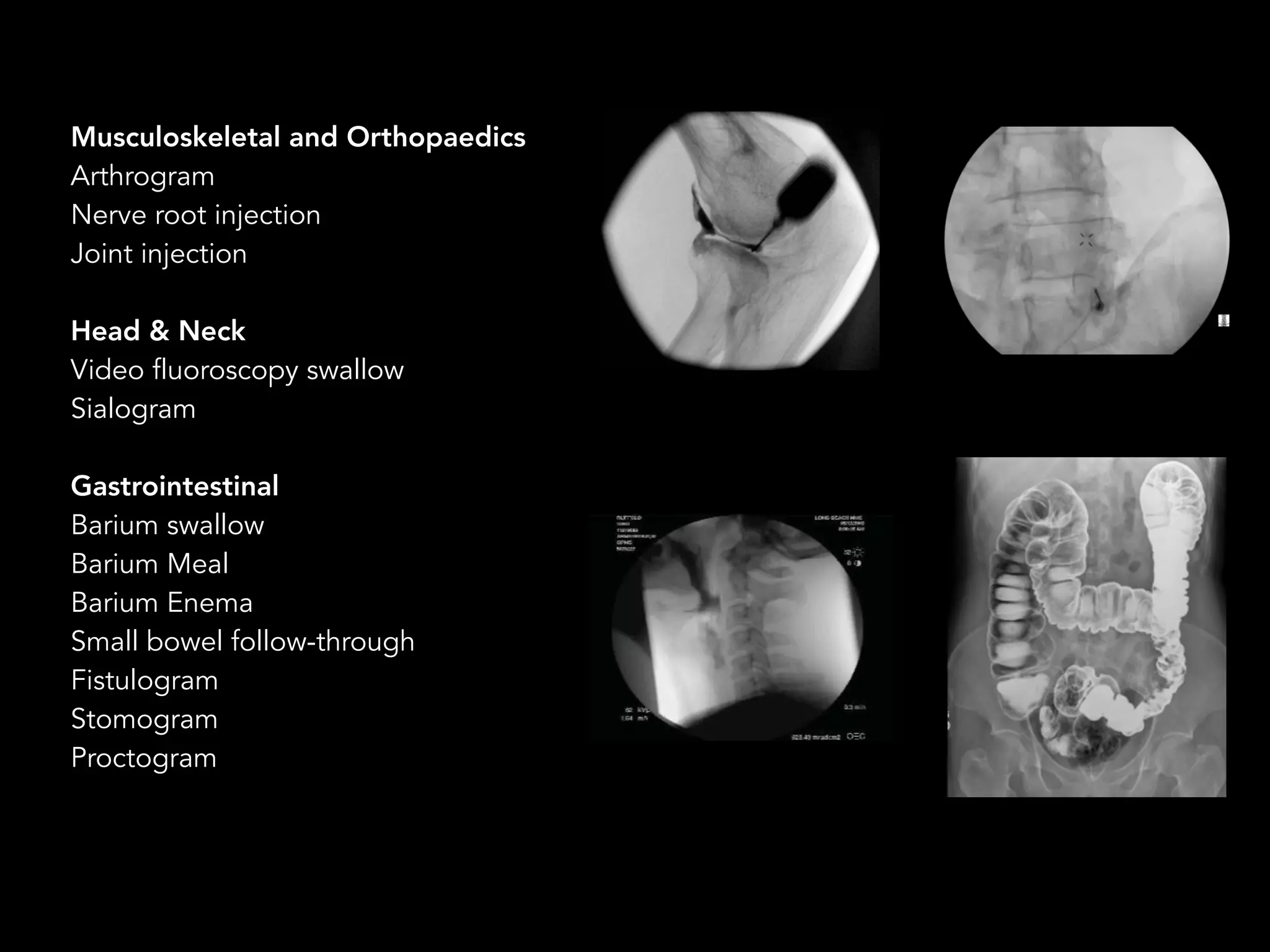 Fluoroscopy for Residents in Radiology | PDF