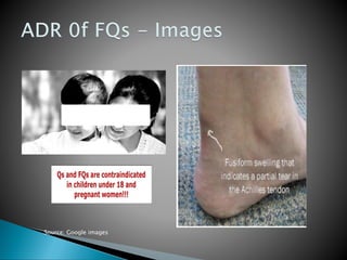 Source: Google images
 