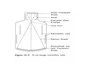 Comprehensive Overview of Fluoroscopy and Image Intensifier Technology ...