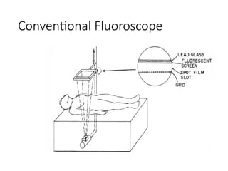 Comprehensive Overview of Fluoroscopy and Image Intensifier Technology ...