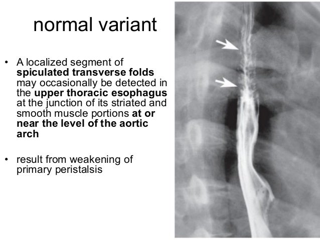 Fluoroscopic techniques and anatomy of pharynx and esophagus final