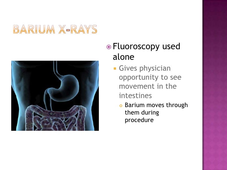 Fluoroscopy ppt