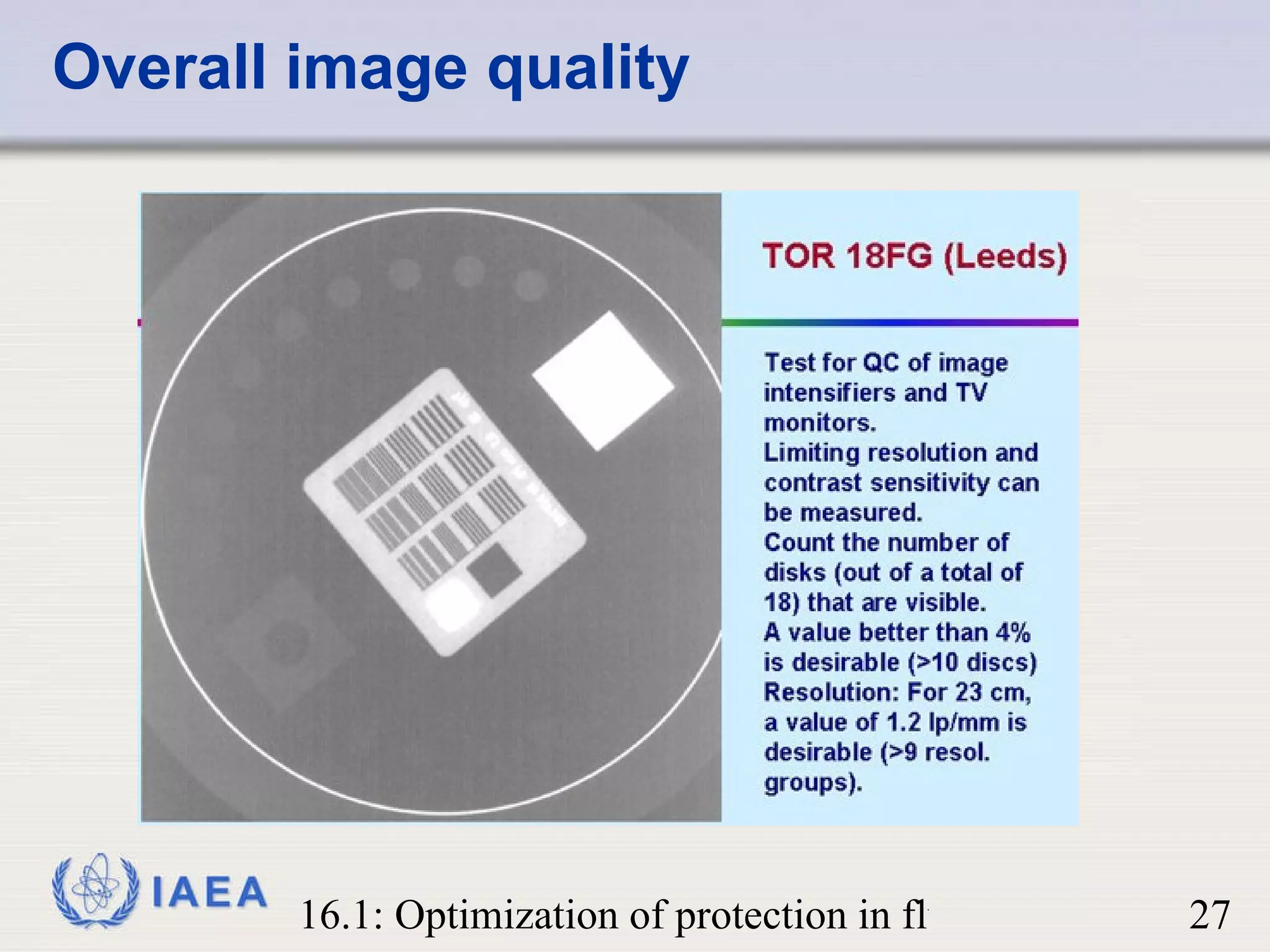 Overall image quality 