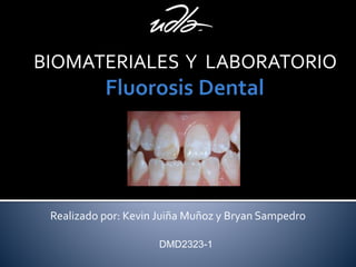 BIOMATERIALES Y LABORATORIO
DMD2323-1
Realizado por: Kevin Juiña Muñoz y Bryan Sampedro
 