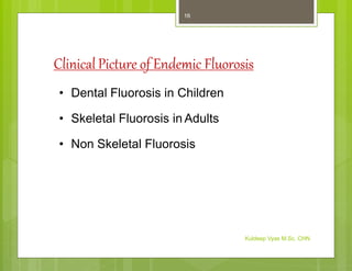 Clinical Picture of Endemic Fluorosis
• Dental Fluorosis in Children
• Skeletal Fluorosis in Adults
• Non Skeletal Fluorosis
Kuldeep Vyas M.Sc. CHN
16
 