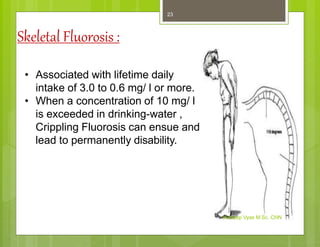 Skeletal Fluorosis :
• Associated with lifetime daily
intake of 3.0 to 0.6 mg/ l or more.
• When a concentration of 10 mg/ l
is exceeded in drinking-water ,
Crippling Fluorosis can ensue and
lead to permanently disability.
Kuldeep Vyas M.Sc. CHN
23
 