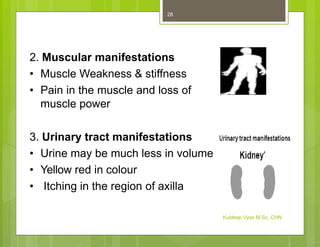 2. Muscular manifestations
• Muscle Weakness & stiffness
• Pain in the muscle and loss of
muscle power
3. Urinary tract manifestations
• Urine may be much less in volume
• Yellow red in colour
• Itching in the region of axilla
Kuldeep Vyas M.Sc. CHN
28
 