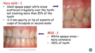 Fluorosis Index- Department of Public Health Dentistry 15
Very mild - 1
• Small opaque paper white areas
scattered irregularly over the tooth-
not involving more than 25% of the
tooth
• <1-2 mm opacity at tip of summits of
cusps of bicuspids or second molar
Mild - 2
• White opaque areas –
more extensive
• <50% of tooth
 