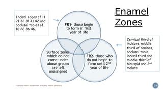Fluorosis Index- Department of Public Health Dentistry 28
FR1- those begin
to form in first
year of life
FR2- those who
do not begin to
form until 2nd
year of life
Surface zones
which do not
come under
above groups
are left
unassigned
Incisal edges of 11
21 32 31 41 42 and
occlusal tables of
16 26 36 46.
Cervical third of
incisors, middle
third of canines,
occlusal table,
incisal third and
middle third of
bicuspid and 2nd
molars
Enamel
Zones
 